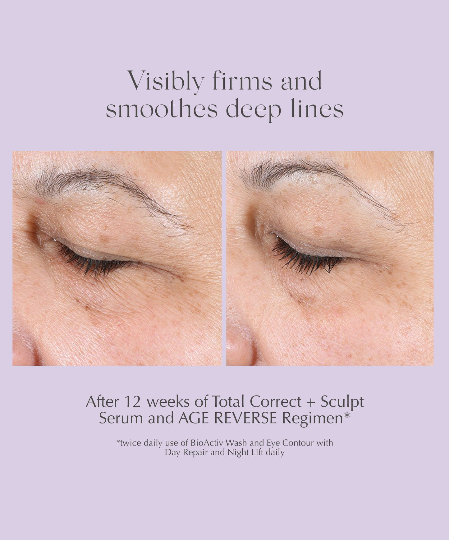 Total Correct + Sculpt Serum Age Reverse