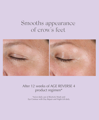 proven results of visible improvement in smoothing appearance of crow's feet after using EXUVIANCE Age Reverse Eye Contour