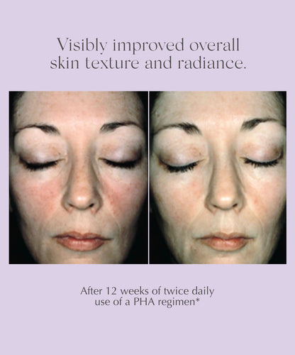 proven results of visible improvement in overall skin texture and radiance after using EXUVIANCE Overnight Transformation Complex