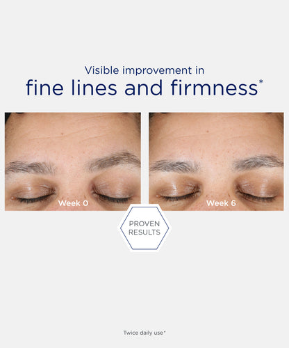 proven results of visible improvement in fine lines and firmness after using NEOSTRATA Skin Active Hyaluronic Luminous Lift