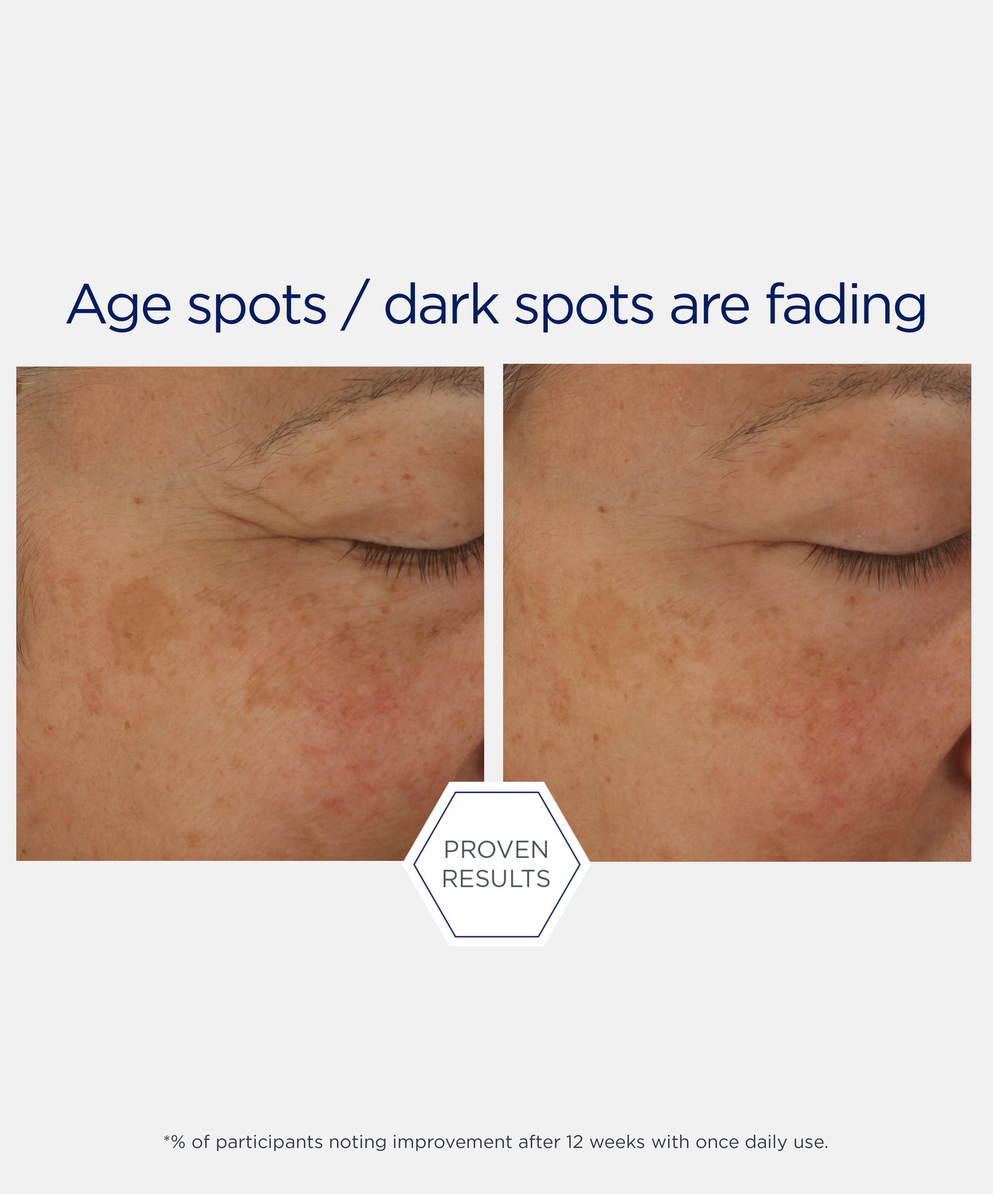 proven results of fading age spots and dark spots after using NEOSTRATA Skin Active Firming Potent Retinol Complex