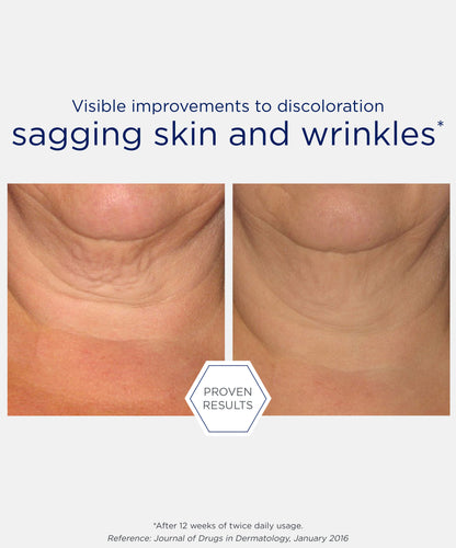 proven results of visible improvements to discoloration sagging skin and wrinkles after using NEOSTRATA Skin Active Firming Triple Firming Neck Cream